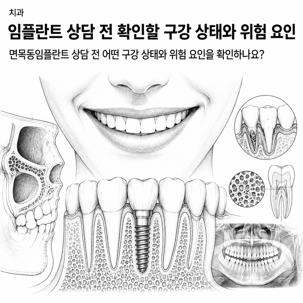 서울 치과 임플란트 상담 전 확인할 구강 상태와 위험 요인 핵심 정보 이미지